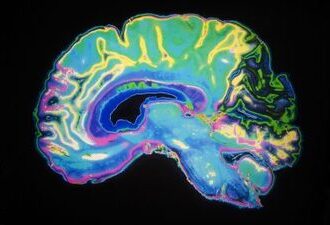 Artificially Colored MRI Scan Of Human Brain